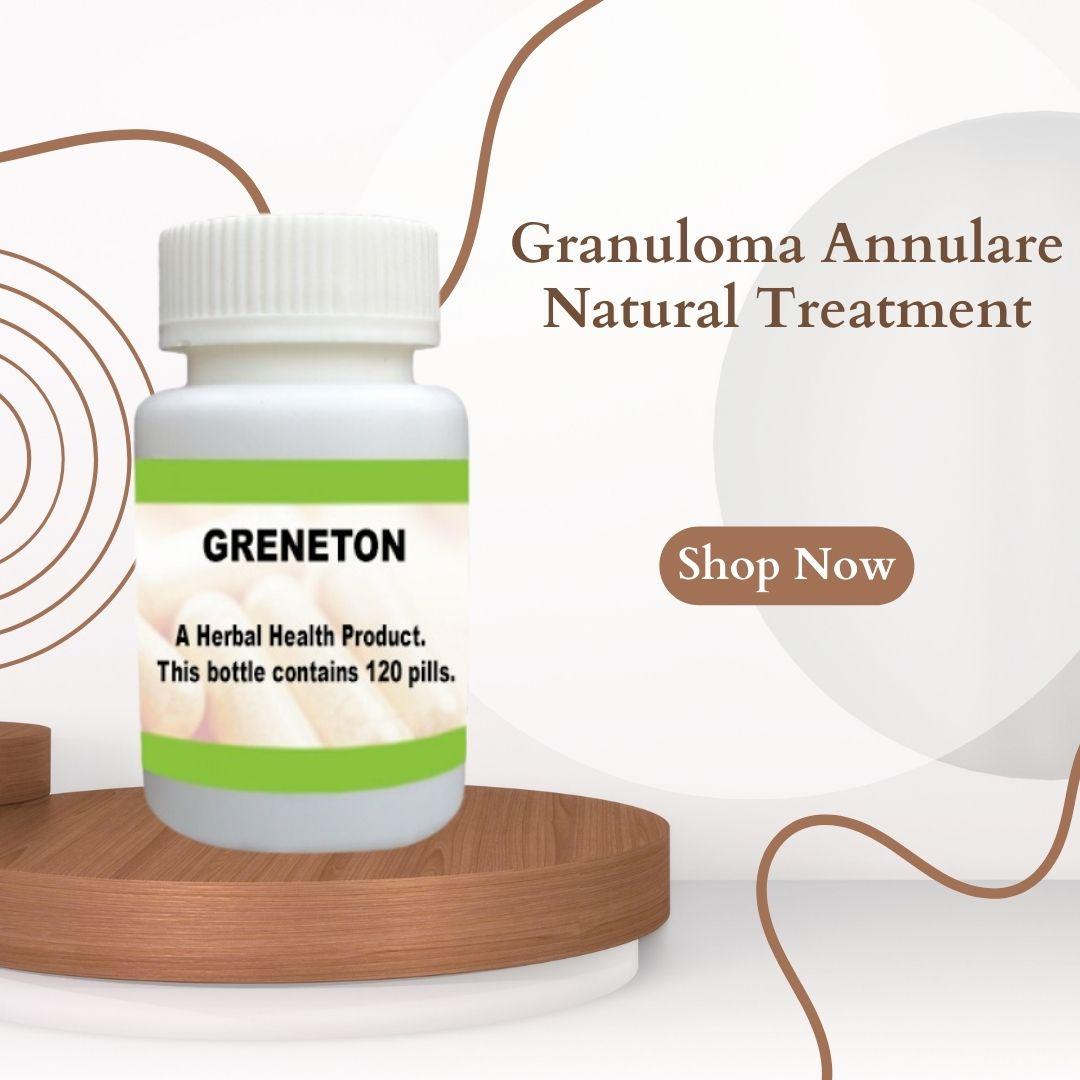 Granuloma Annulare Natural Treatment
