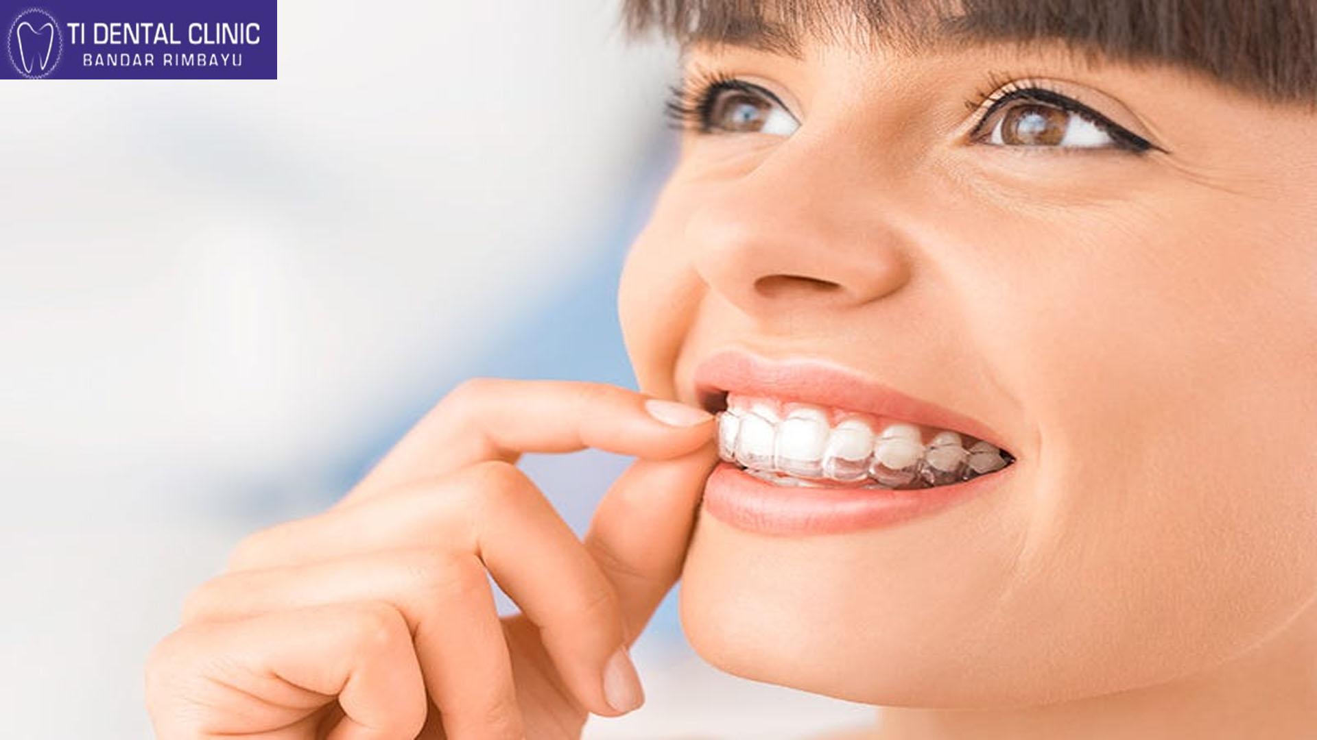 Invisible Braces Dentist Consultation Clear Aligner Journey...