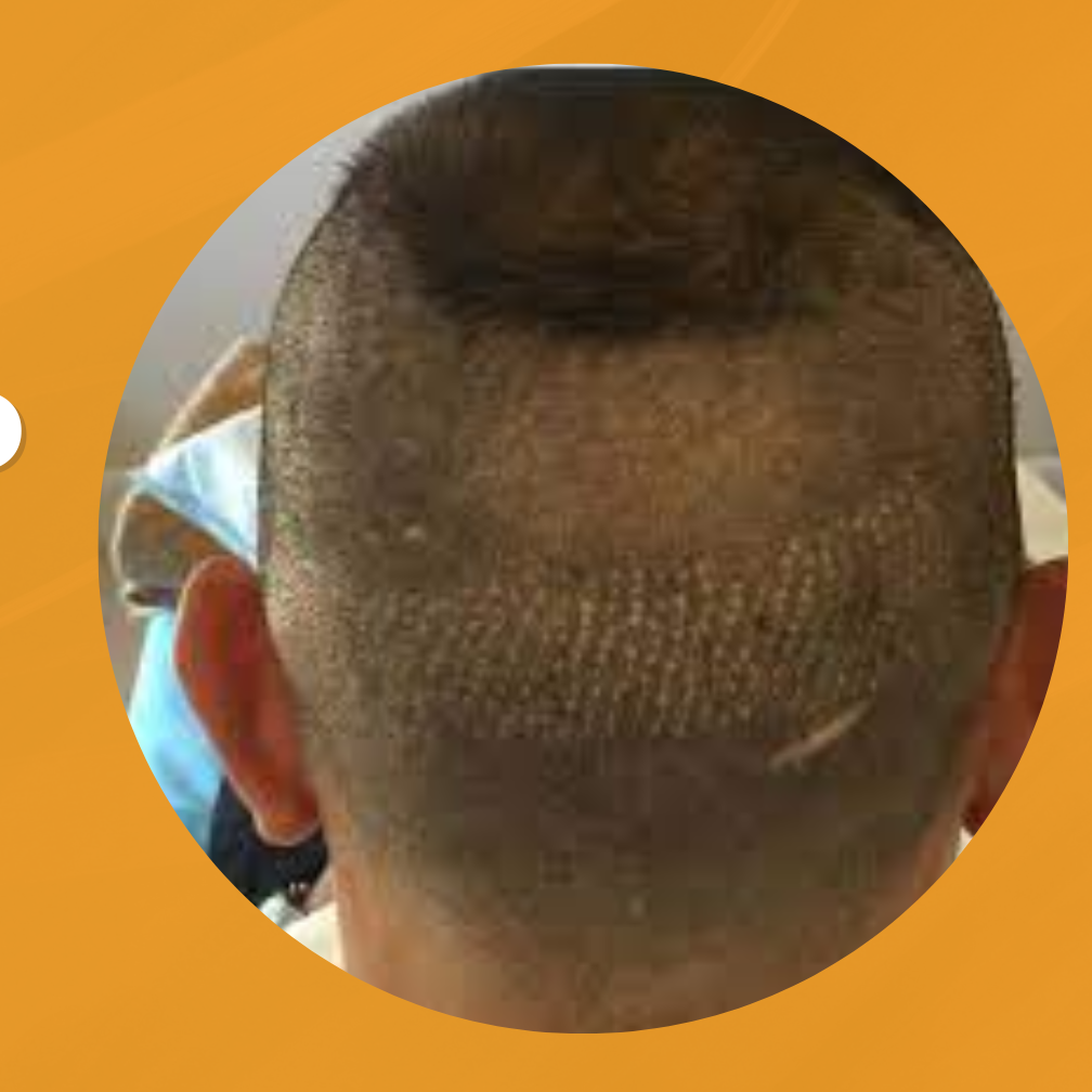 Panacea Global Hair Services