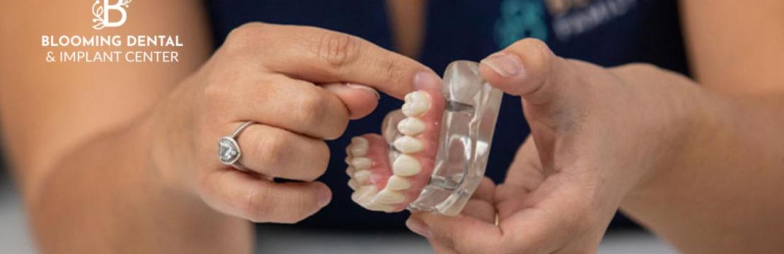 Blooming Dental And Implant Center