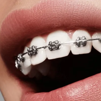 DentalClinic Dubai