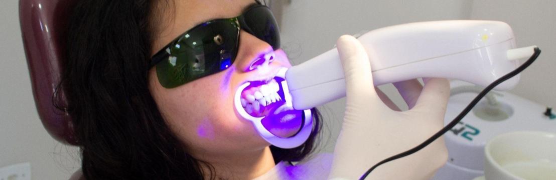 Best Teeth Whitening Studio Brisbane